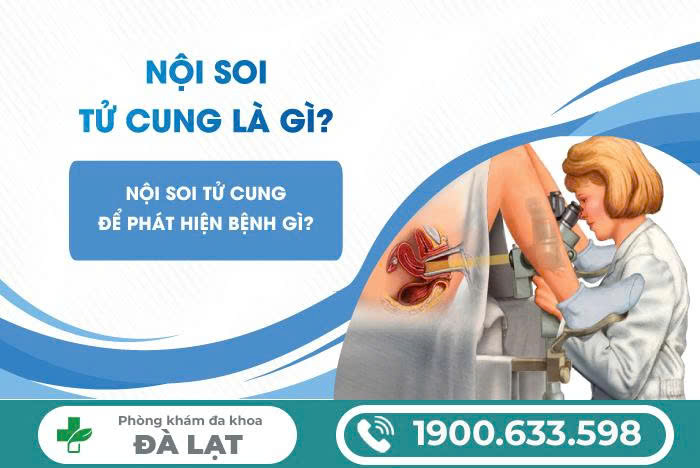 Hình ảnh minh họa